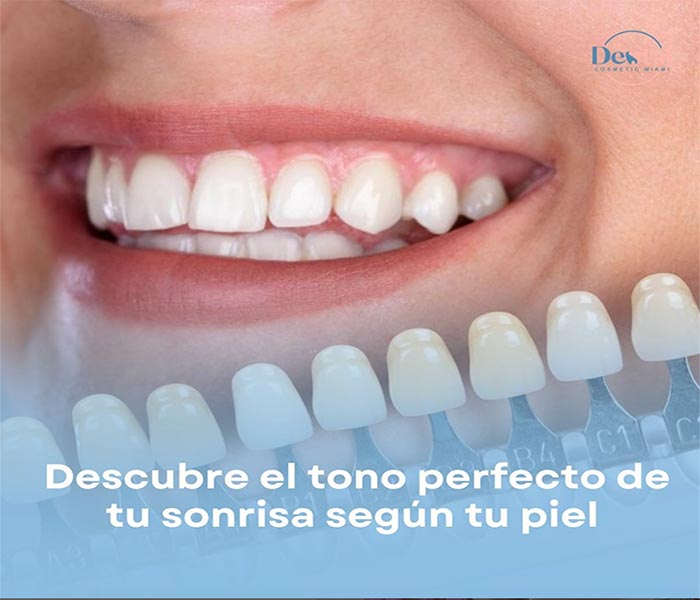 Diseño de Sonrisa