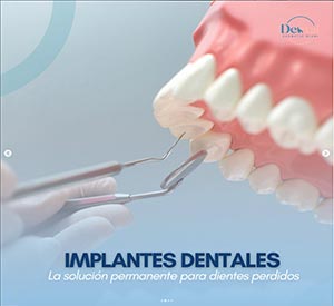 Diseno de Sonrisa - Dental Cosmetic Miami