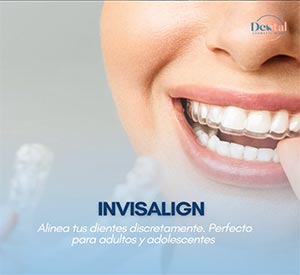 Diseño de Sonrisa - Dental Cosmetic Miami
